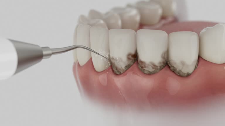 Reliable Root Canal Treatment contractor in Cumberland County County, NC by Dentist Open Now